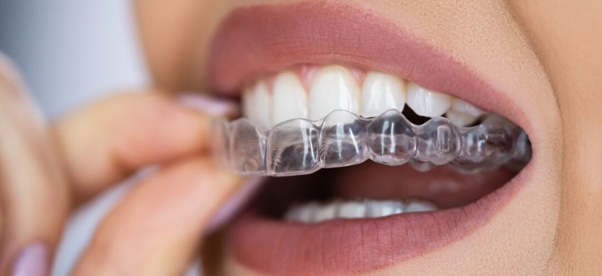 Invisalign Treatment